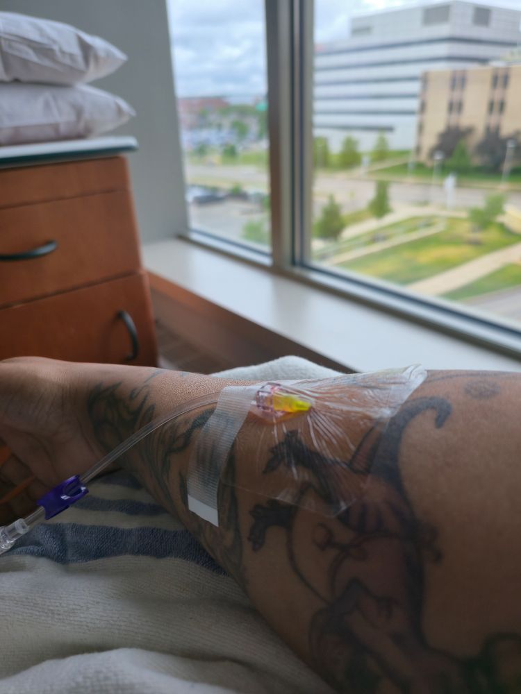 An arm with an iv inserted looking out of a hospital window with buildings and a street below