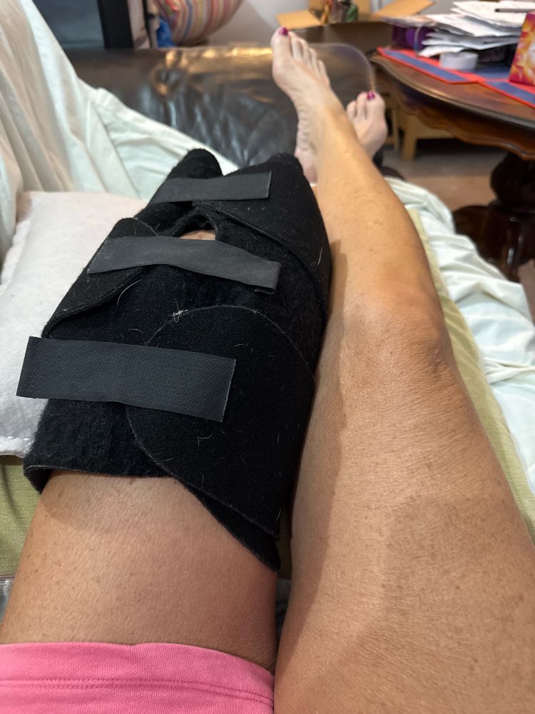 Two legs stretched out - one with a black ice support on it. 