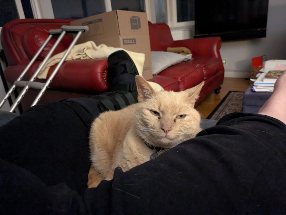 Orange cat sits between a person's legs with what appears to be a smug smile of contentment. The person's left foot is in an immobilization boot. In the background is a red leather couch that has a moving box on it, and crutches leaning against the armrest.