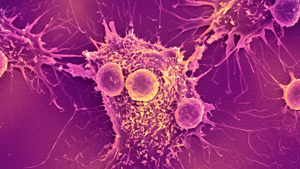 A new mRNA-based vaccine triggers a response from the innate immune system to help arm the body against cancer, a mouse study finds. It's now in early human trials.