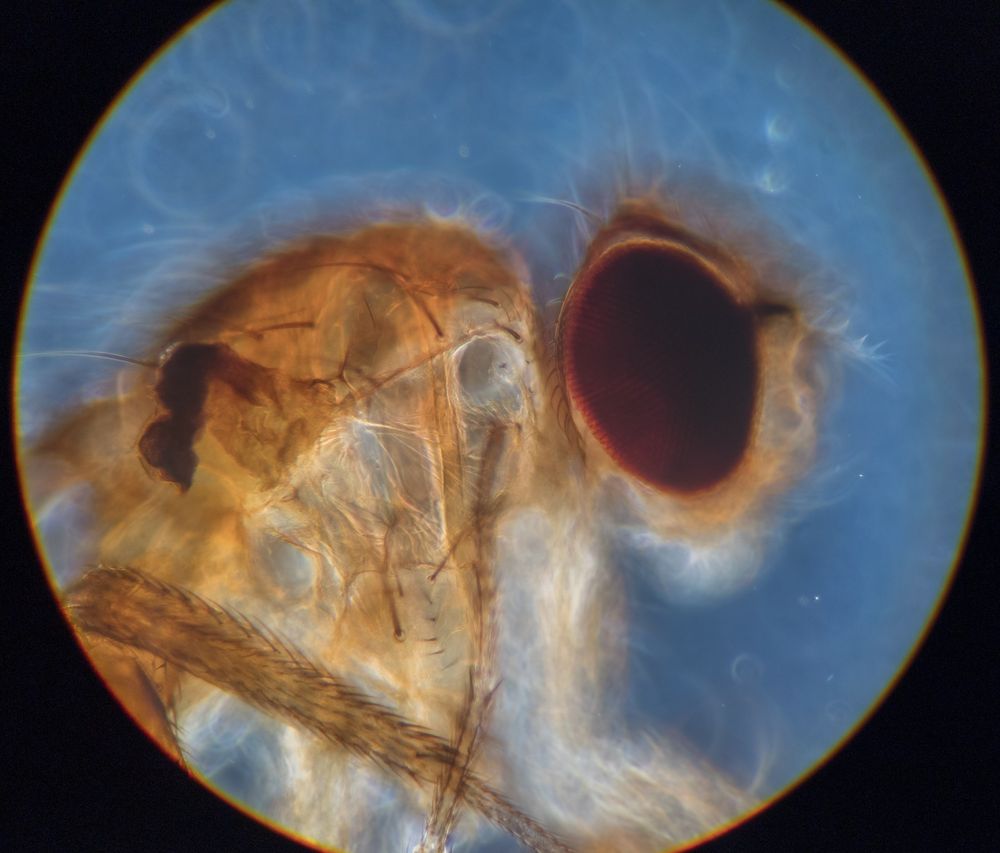 smartphone through ocular microscope picture showing a partially translucent fruit fly against a pale blue background. It's legs are covered in many little spiky hairs and it has large dark compound eyes.