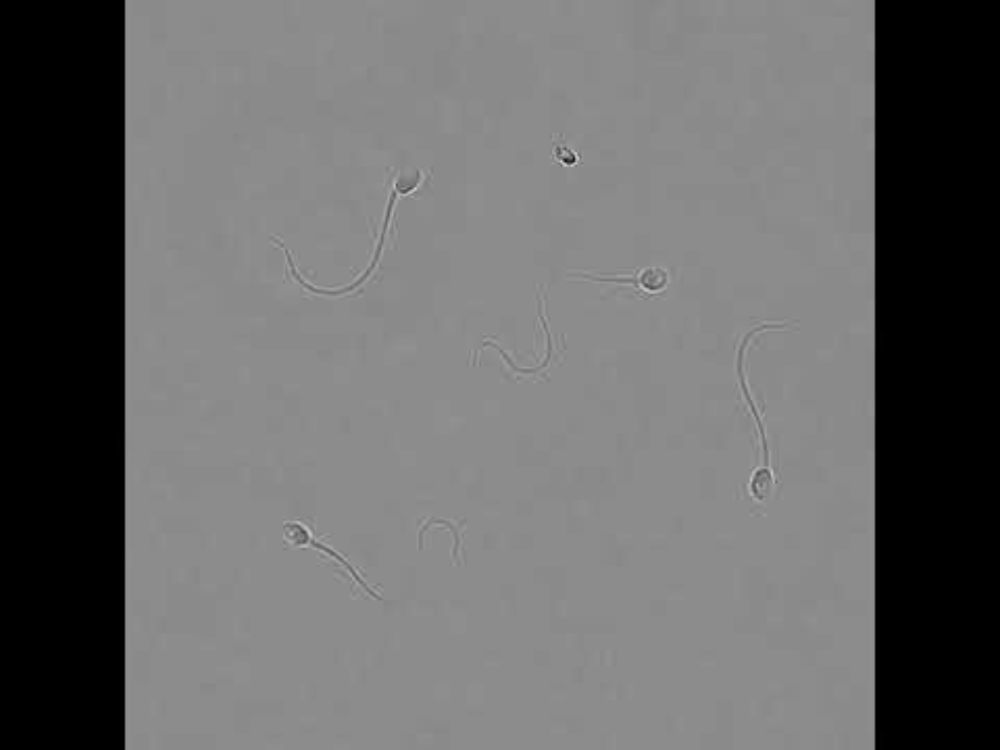Human Sperm Differential Interference Contrast (DIC)