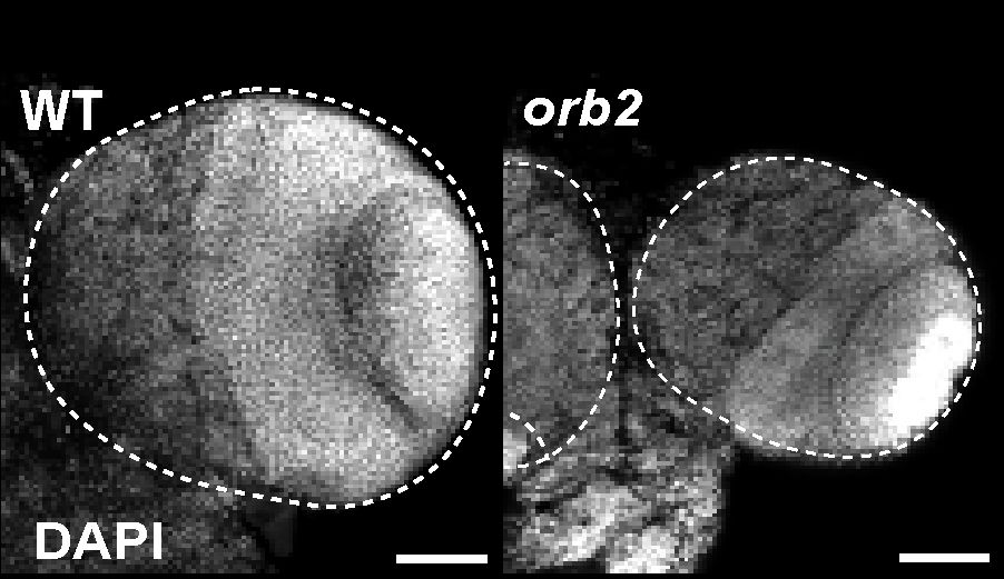 Image shows a fluorescence micrograph of two, age-matched Drosophila larval brains. The brain on the left is from the WT control, and the brain on the right is from an orb2 null mutant. The orb2 mutant brain is much smaller than the control. These brains were stained for DAPI to measure the volume of the optic lobes (dashed area).