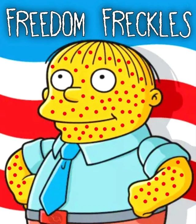 Cartoon of Ralph Wiggum in front of an American flag. He has red spots all over his skin and above him are the words, “Freedom Freckles”