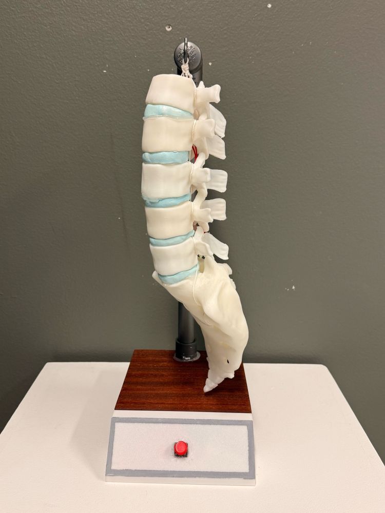 A 3D printed sculpture of the lumbar, sacrum, and coccyx. The spinal discs are painted a light blue to contrast the white bones. The structure is hung up and a red button is attached on the base of the sculpture.
