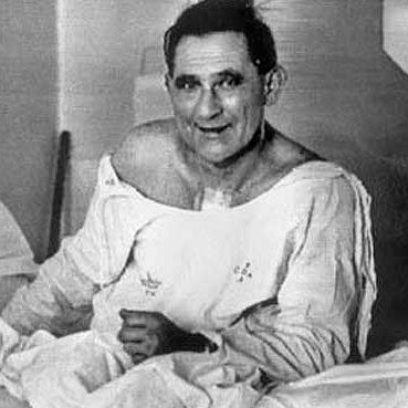 Photograph of Louis Washkansky, the first human-to-human heart transplant recipient