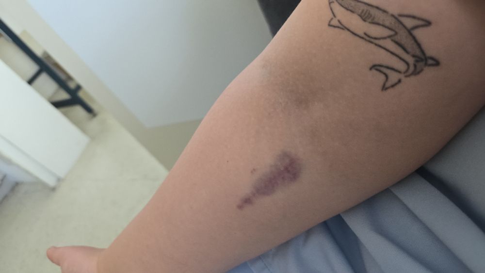 Der gleiche blaue Fleck, aber breiter. 