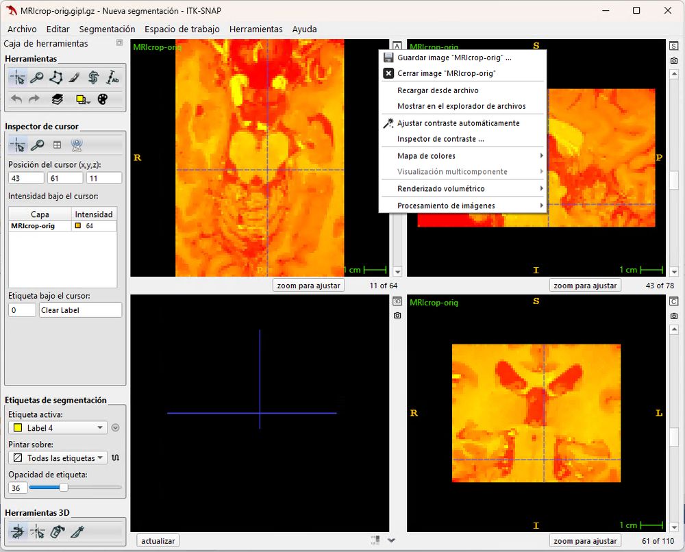 Screenshot of ITK-SNAP in Spanish