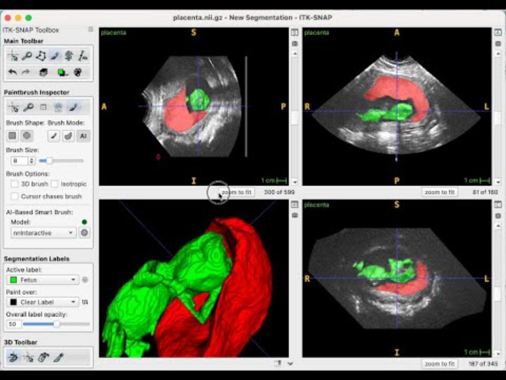 Demo of new Deep Learning Segmentation in ITK-SNAP 4.4