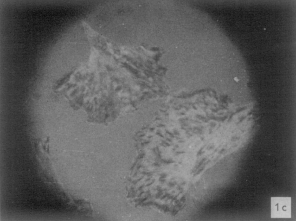 A still from a cine film down a microscope showing dark patches in two cells that are recognisable to a cell biologist nowadays as focal adhesions. The view is through the eyepieces i.e. circular, as though we are spying on the cells.