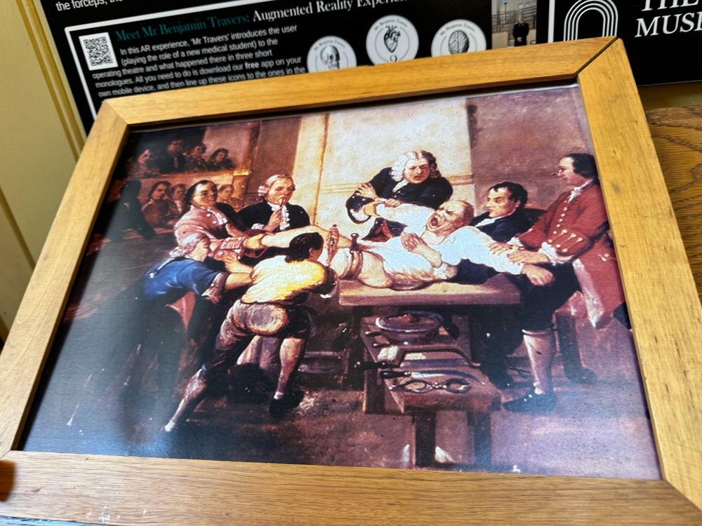 Painting reproduction displayed at The Old Operating Theatre Museum in London depicting a 19thC, pre-anesthesia surgery requiring seven men to forcibly hold down a conscious patient. 
