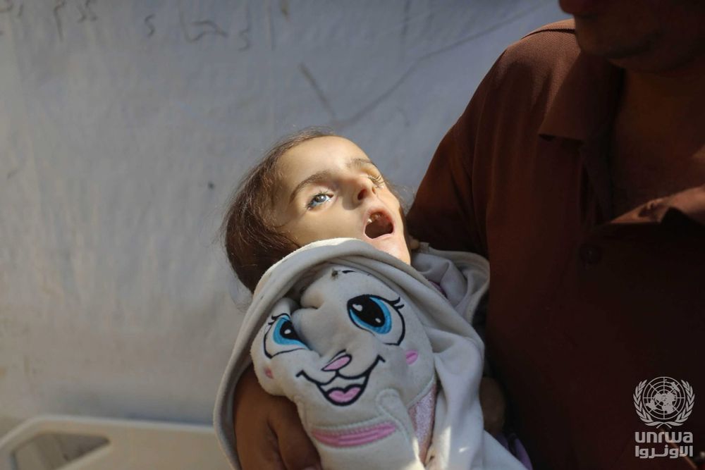 Photo d’un enfant palestinien de deux ans sous alimenté 