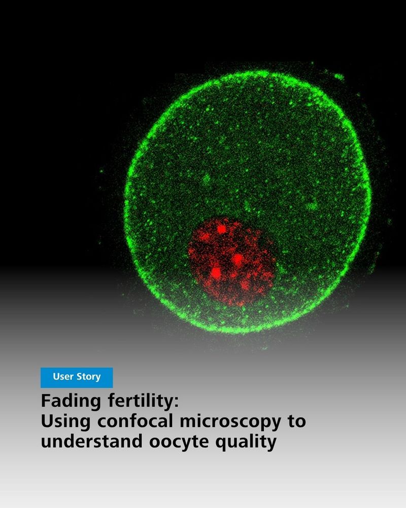 Confocal microscopy image showing an oocyte with a large green-stained area and a smaller red-stained area, illustrating research on oocyte quality. Text overlay "User Story - Fading fertility: Using confocal microscopy to understand oocyte quality"