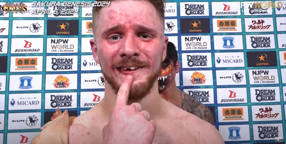 Picture of Francesco Akira showing his chipped tooth