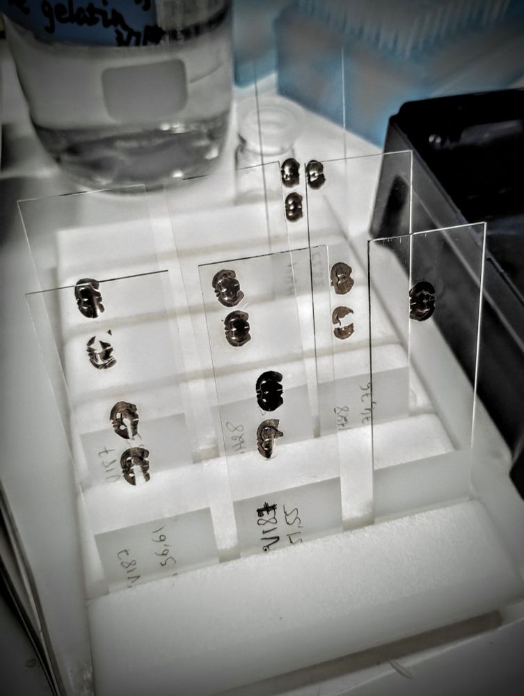 Mouse brain sections on glass slides