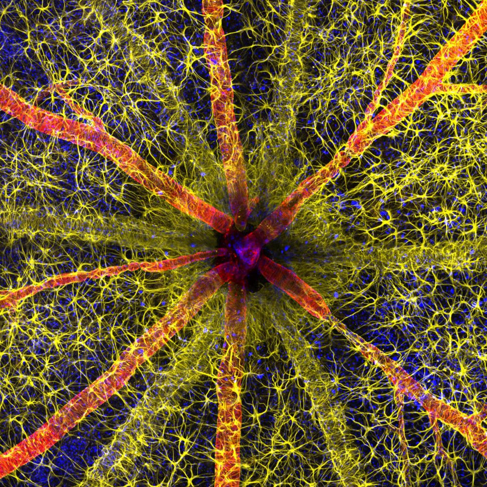 Rodent optic nerve head | 2023 Photomicrography Competition