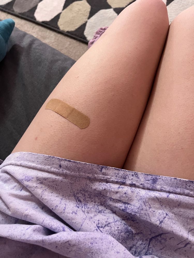 Photo of Tori’s thighs with a bandaid on her left thigh