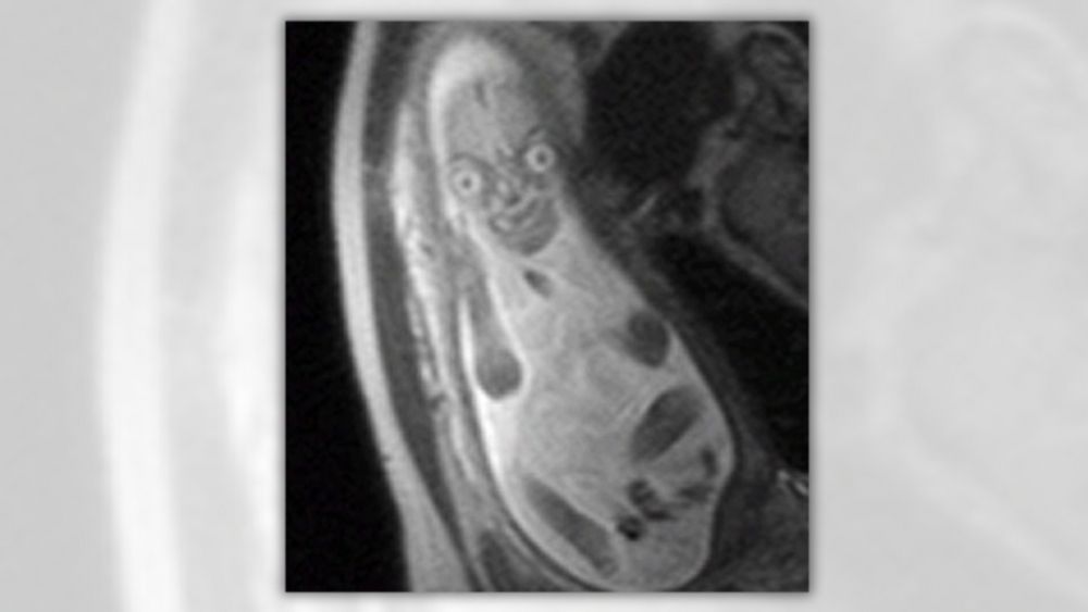 Do These Images Show Actual MRIs of Human Fetuses?