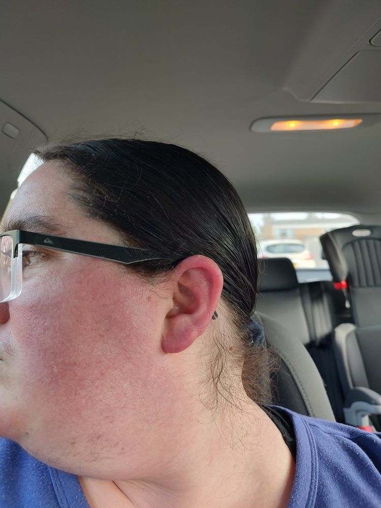 Left cheek and ear both looking redder than the surrounding skin.