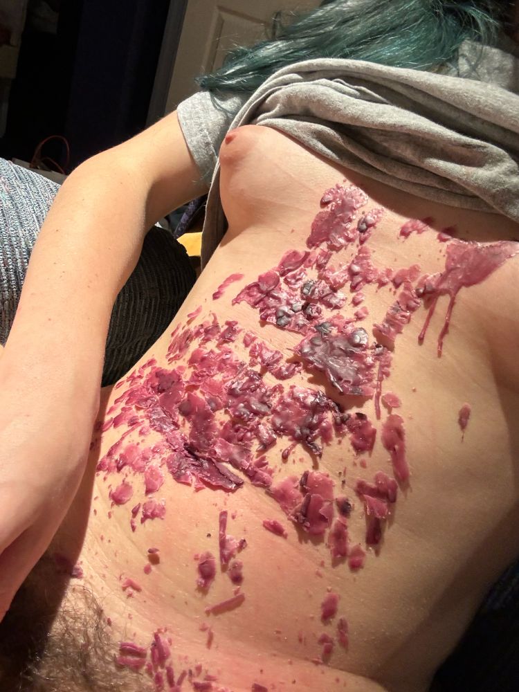 purple wax drippings heavily cover aconite's chest and tits, dark with candlesmoke in spots, claw acratches stretching between its perky tits. its face and dick are out of frame here, but it seems no less smug and content for it.