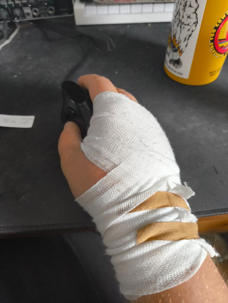  Meine Hand an einer aufrechten Computermaus, verbunden mit einer Mullbinde die mit Pflastertape fixiert ist.