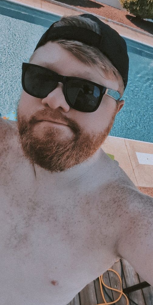 A shirtless selfie in front of my pool with a black hat on backwards, and black sunglasses on. My shoulders are covered in more freckles then usual