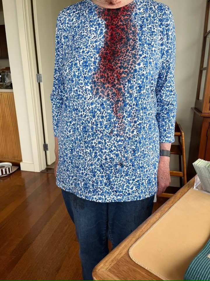 Peaceful proster beaten in Portland by federal agents