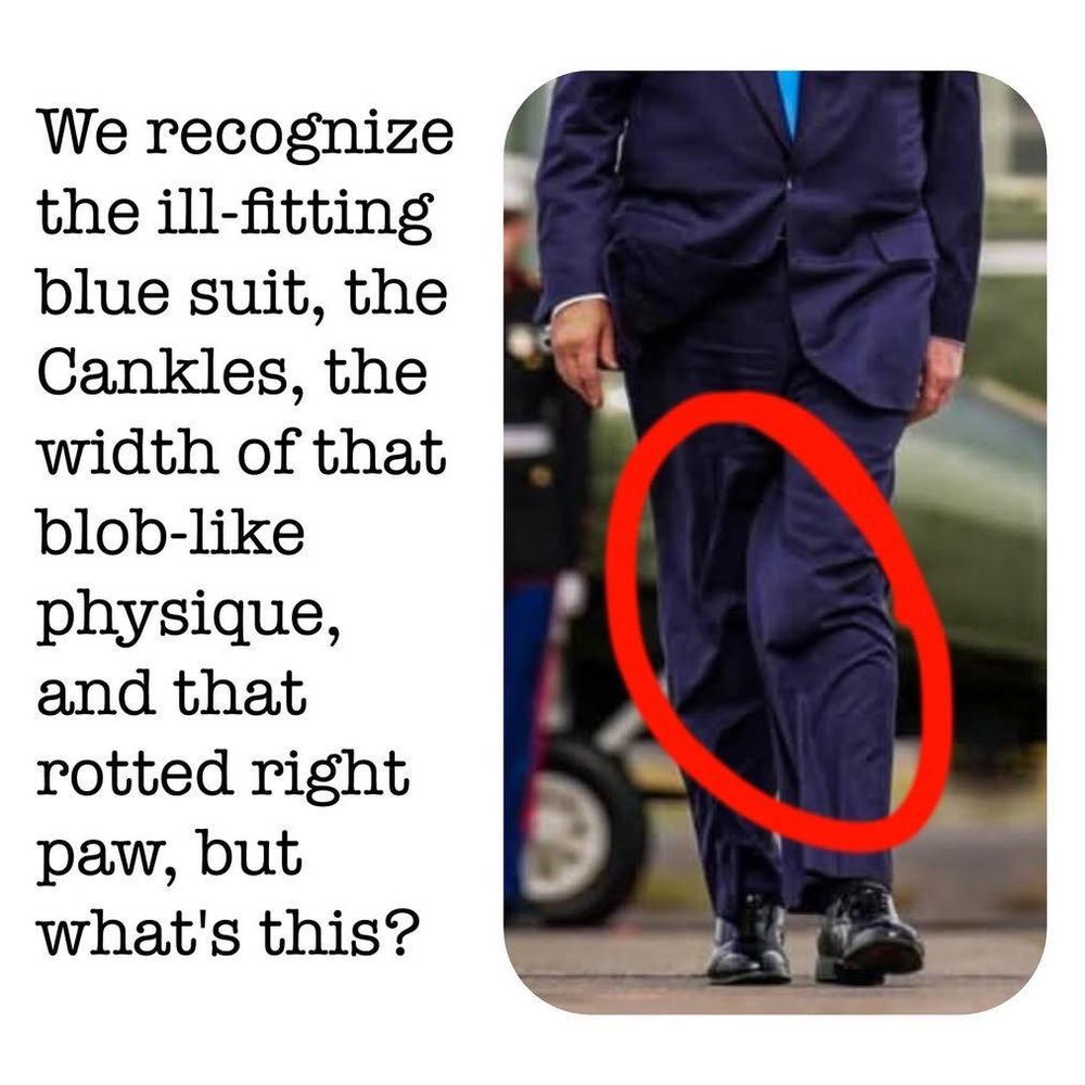 Some device is attached to Trump's knee under his pants.