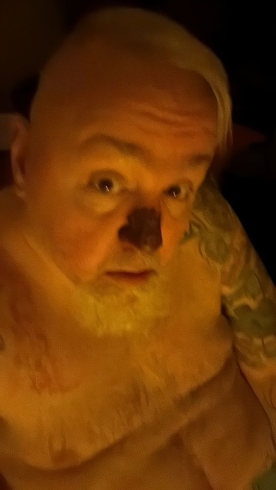 Here is why.  Had some worrisome spots laser removed from my nose.  2nd time and hope it’s the last   