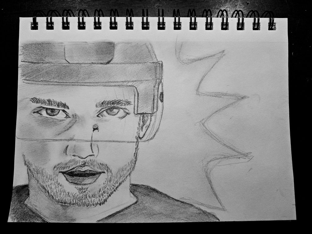 Pencil drawing, portrait, looking directly at viewer. Black eye, cut to nose.