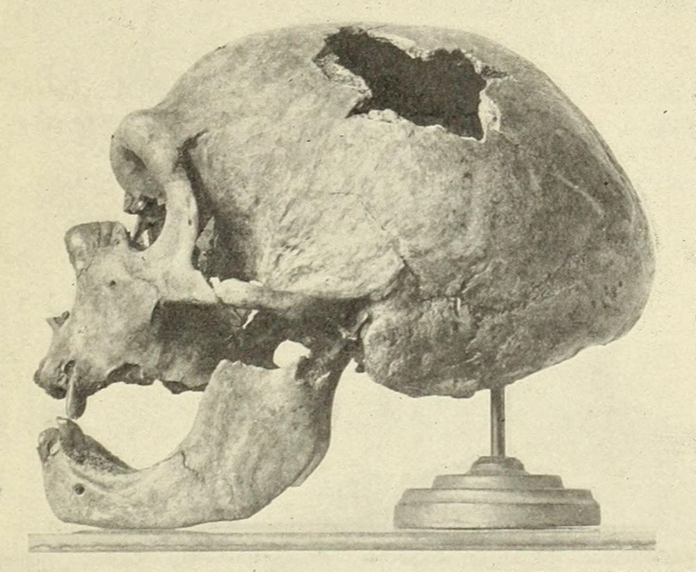 A black-and-white photograph of a Neanderthal skull in right profile view, displayed on a small pedestal. The cranium shows a large, irregular hole on the parietal region. The skull has a robust brow ridge, receding forehead, and protruding midface. The mandible is present.