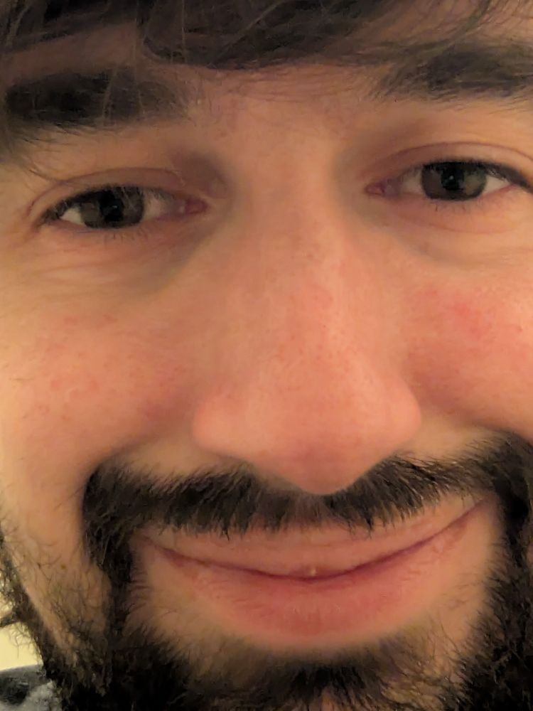 Gros zoom sur mon visage