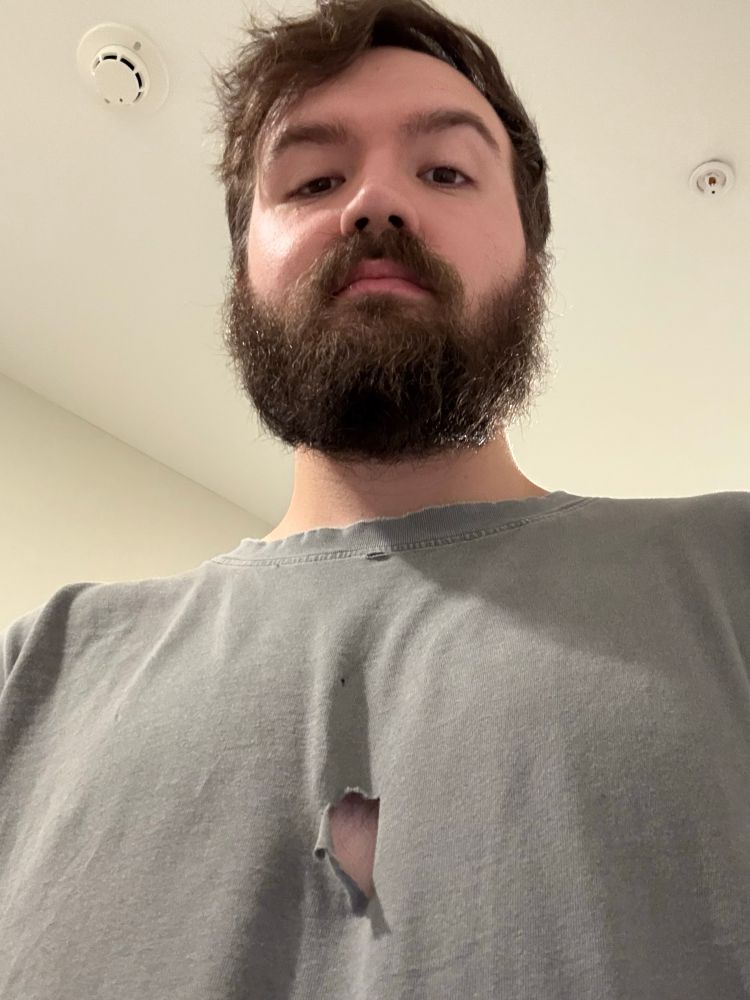 Andrew (still disheveled but less sleep deprived) with a large hole in his shirt made by a very scared kitten. 