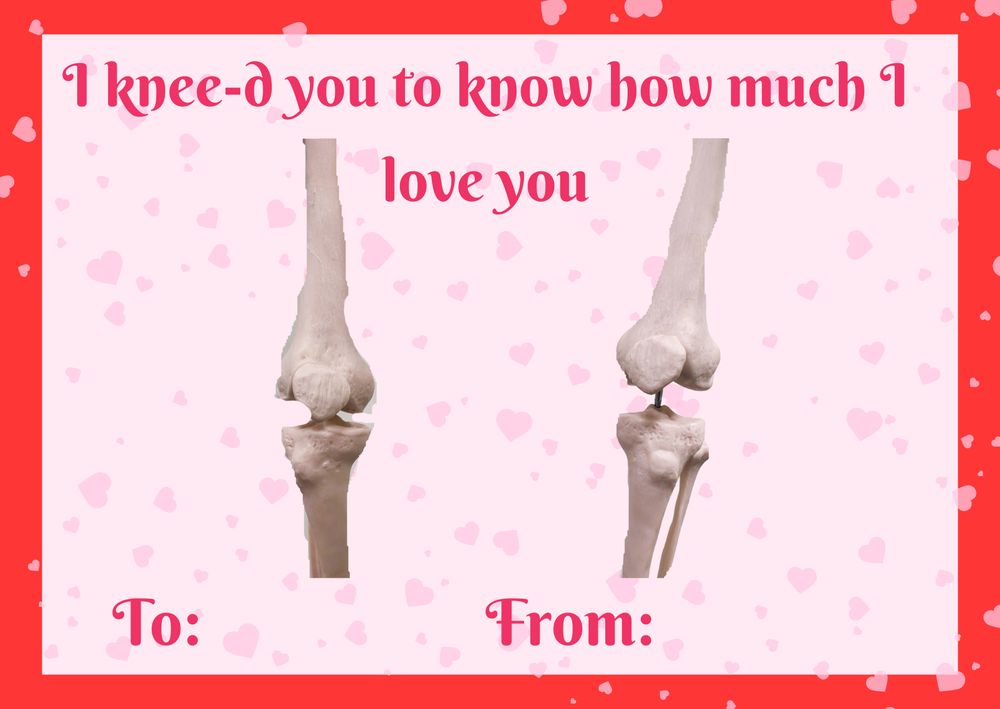 Light pink postcard with a bright outline, scattered with hearts. Text at the top of the postcard reads "I knee-d you to know how much I love you" then there is an image of a pair of knee bones. Underneath is written "To:" and "From:" with space for names to be added.