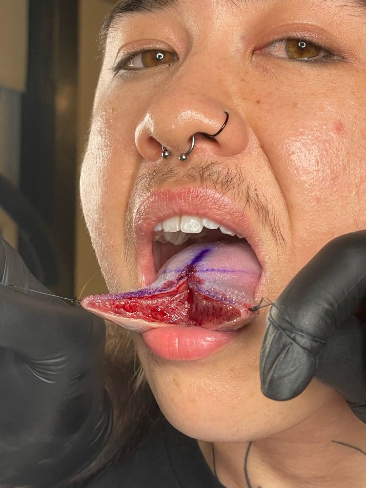 freshly split tongue pulled wide open by its threaded tips, begging for you to give into your carnal desires. it’s about to be sutured but we take pause, my eyes fixed on yours, our pulses syncing. i look my best with my insides on the outside. raw meat wet and exposed, muscles mutilated. you can see my molars, you can smell my flesh. you don’t even want to stitch me up, do you? this is my first time feeling my tongues touch opposite corners of my mouth. if you get closer and abandon inhibition, it just might be my last. meat goes bad. don’t let it happen to the finest cut you’ve ever seen.