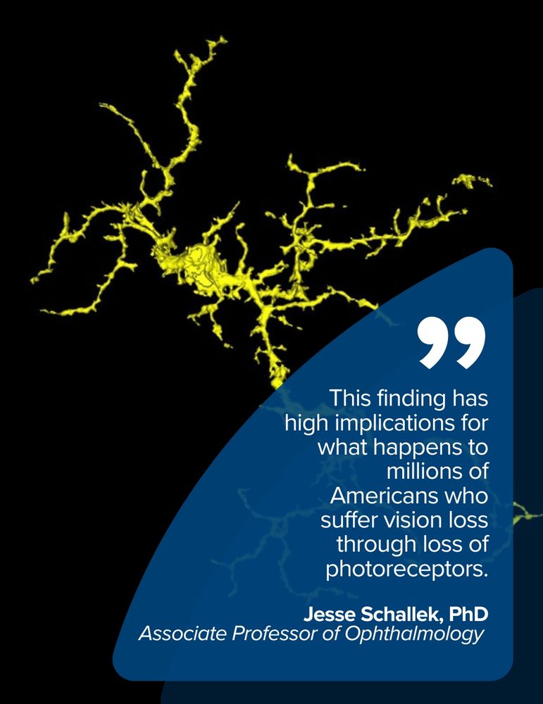 This finding has high implications for what happens to millions of Americans who suffer vision loss through loss of photoreceptors. Jesse Schallek, PhD, associate professor of Ophthalmology