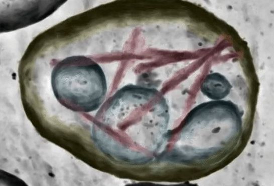 Cryo-Et image of a brain extracellular vesicle
