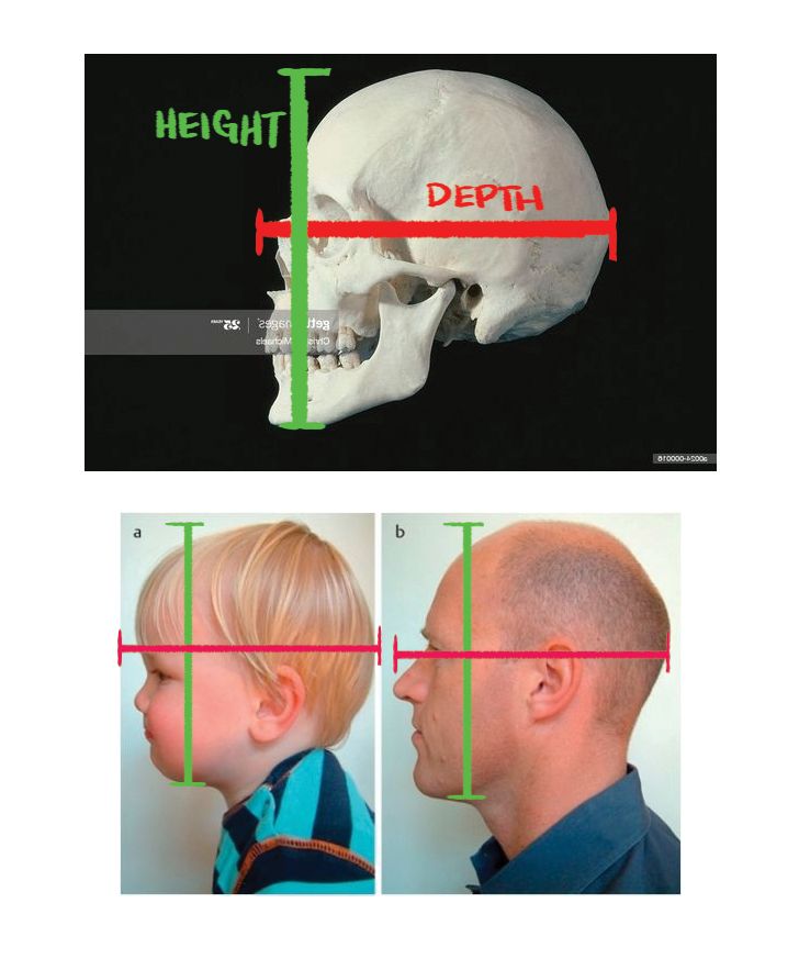 More simple diagrams:
1. A stock photo of a skull in profile. The height and depth are both illustrated to be the same length.
2. A stock photo of a child and an adult in profile. The same two equidistant lines are imposed over the photos, to illustrate that the depth and length of the skull are generally equidistant at any age.
