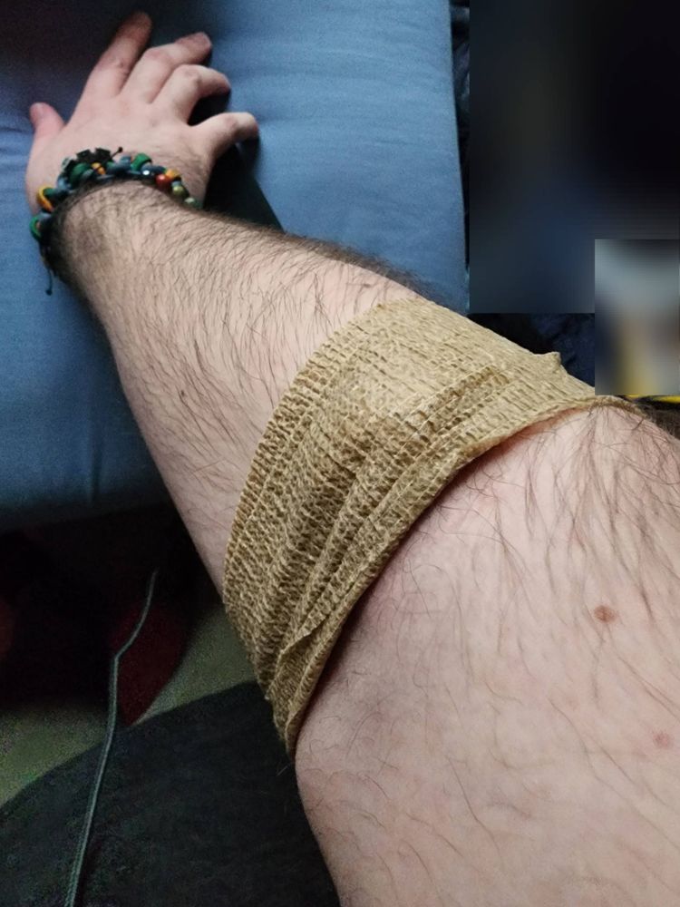 Image of my arm with a flex-wrap bandage on it from a blood draw for medical labs.