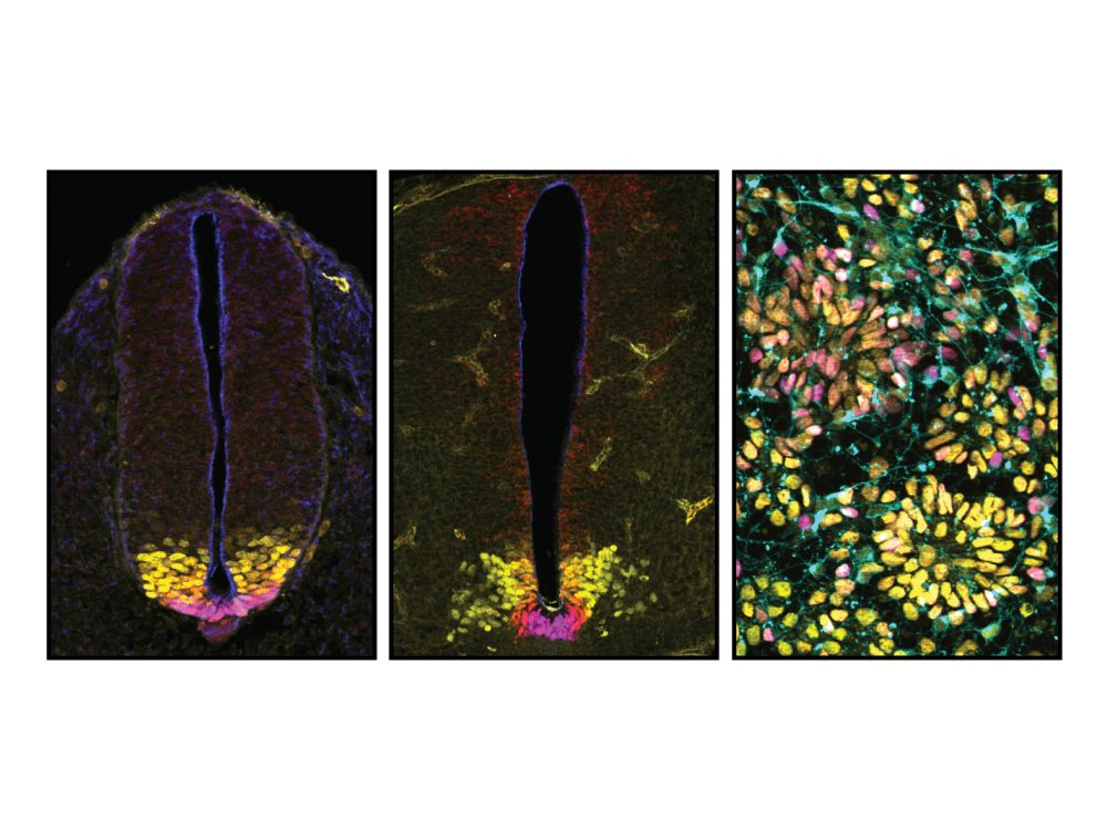 Fluorescence microscopy pictures of spinal cord development and cellular models