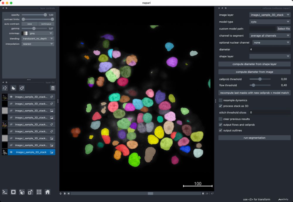 Cellpose segmentation and applied parameters