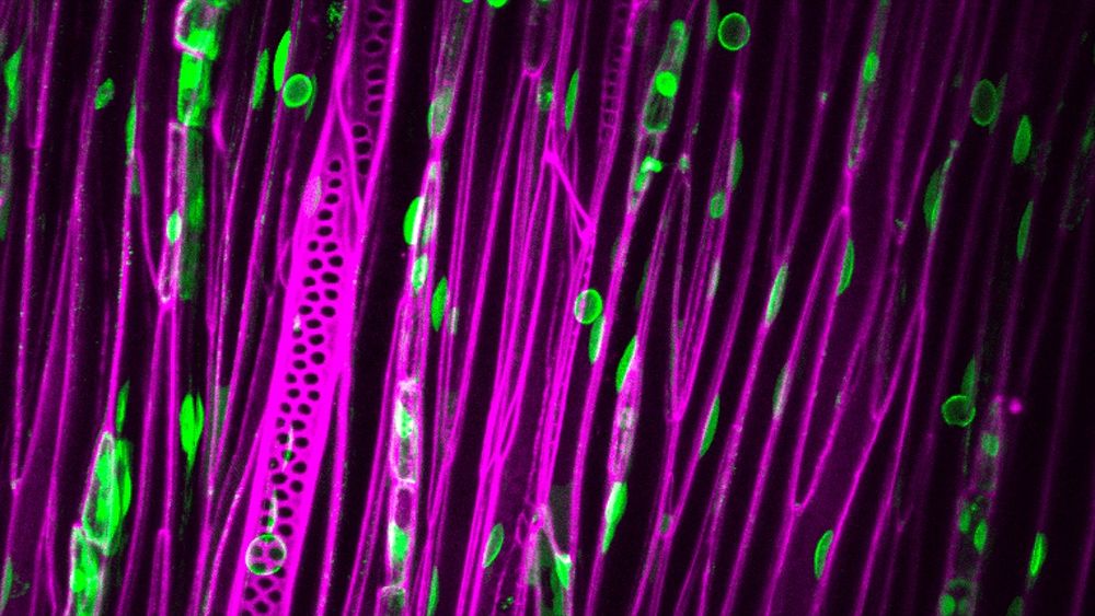 Microscopic image of wood tissue with fibres and tracheids labeled in pink and some compartments within the cells in green. Photo: Stephan Verger