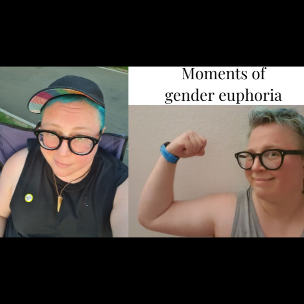 Help me get gender-affirming top surgery, organized by Kai Andie Katschthaler