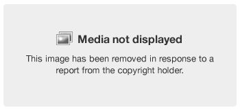 Media not displayed. This image has been removed in response to a report from the copyright holder
