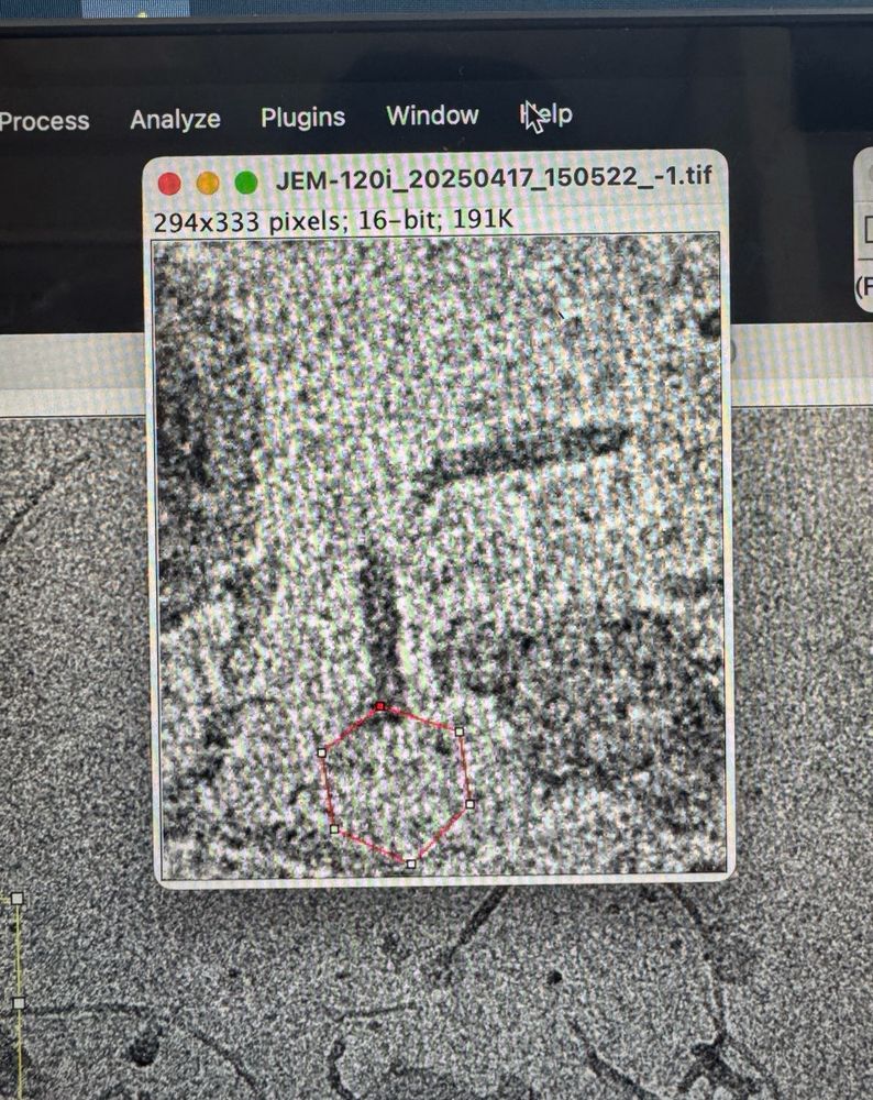 A TEM image of a bacteriophage with a burst head and a broken tail tube