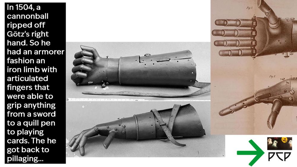 IMAGE 1 DESCRIPTION: Two black and white photos of Götz’s iron hand, one showing the fingers splayed and the others showing them balled into a fist. In addition to the articulated fingers, the metal prosthetic has a cylindrical forearm segment and straps to hold the limb in place.

  IMAGE 2 DESCRIPTION: A series of illustrations give an exploded view of how the fingers on Götz’s iron hand extend and retract.

  ONSCREEN CAPTION READS: In 1504, a cannonball ripped off Götz’s right hand. So he had an armorer fashion an iron limb with articulated fingers that were able to grip anything from a sword to a quill pen to playing cards. The he got back to pillaging...