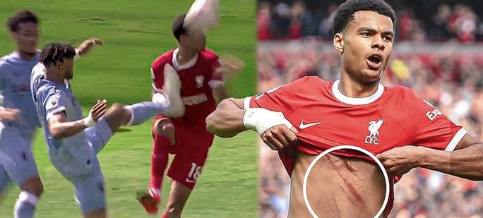 gakpo getting a studs up challenge to the chest and lifting his shirt to show the wounds