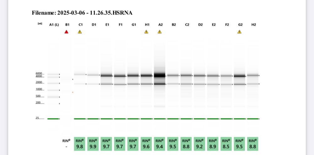 Data showing rRNA bands