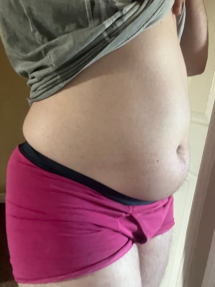 huge bladder bulge, 3/4 view