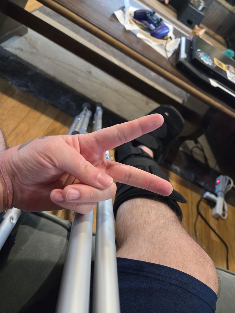 Picture of my leg in a boot and crutches while I'm doing a peace sign at the camera